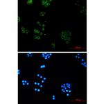 SNX5 Recombinant Rabbit Monoclonal Antibody (K01_1K91)