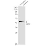 SNX5 Antibody in Western Blot (WB)