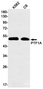 PTF1A Recombinant Rabbit Monoclonal Antibody (K01_1K89)