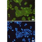 alpha Actinin 4 Antibody in Immunocytochemistry (ICC/IF)