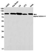 alpha Actinin 4 Antibody in Western Blot (WB)
