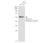 ACVR1B Recombinant Rabbit Monoclonal Antibody (K01_1M35)