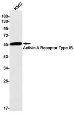 ACVR1B Antibody in Western Blot (WB)
