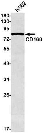 RHAMM Recombinant Rabbit Monoclonal Antibody (K01_1P08)
