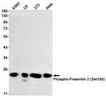 Phospho-PSEN2 (Ser330) Antibody in Western Blot (WB)