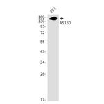 AS160 Recombinant Rabbit Monoclonal Antibody (K01_1N10)