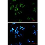 DLD Recombinant Rabbit Monoclonal Antibody (K01_1K83)