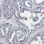 DLD Antibody in Immunohistochemistry (Paraffin) (IHC (P))