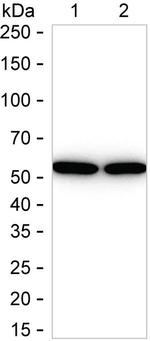 DLD Antibody in Western Blot (WB)