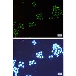 NAT10 Recombinant Rabbit Monoclonal Antibody (K01_1K48)