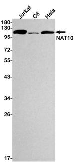NAT10 Antibody in Western Blot (WB)