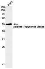 ATGL Antibody in Western Blot (WB)