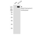 ACACB Recombinant Rabbit Monoclonal Antibody (K01_1M31)