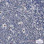 PREB Recombinant Rabbit Monoclonal Antibody (K01_1K98)