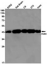 ACTA1 Antibody in Western Blot (WB)