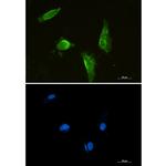 Aprataxin Recombinant Rabbit Monoclonal Antibody (K01_1M95)