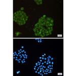 ARPC2 Recombinant Rabbit Monoclonal Antibody (K01_1N06)