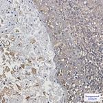 ARPC2 Antibody in Immunohistochemistry (Paraffin) (IHC (P))