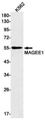 MAGEC2 Antibody in Western Blot (WB)