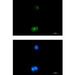 GYPC Recombinant Rabbit Monoclonal Antibody (K01_1L15)