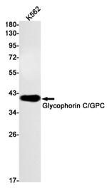 GYPC Antibody in Western Blot (WB)