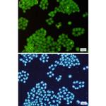 Annexin A6 Recombinant Rabbit Monoclonal Antibody (K01_1K71)