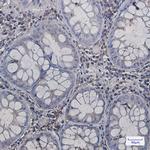 Annexin A6 Antibody in Immunohistochemistry (Paraffin) (IHC (P))