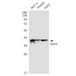 ADH5 Recombinant Rabbit Monoclonal Antibody (K01_1M39)