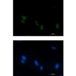 Phospho-RSK4 (Ser232) Recombinant Rabbit Monoclonal Antibody (K01_1L65)