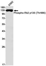 Phospho-p130 (Thr986) Antibody in Western Blot (WB)