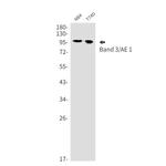 Band 3 Recombinant Rabbit Monoclonal Antibody (K01_1N44)