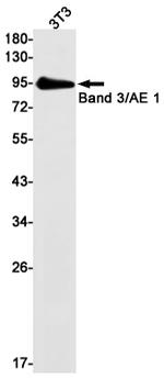 Band 3 Antibody in Western Blot (WB)