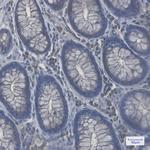RAB8A Antibody in Immunohistochemistry (Paraffin) (IHC (P))