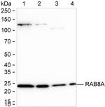 RAB8A Antibody in Western Blot (WB)