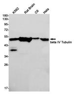 beta-4 Tubulin Antibody in Western Blot (WB)