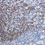 Cytokeratin 16 Recombinant Rabbit Monoclonal Antibody (K01_1L18)