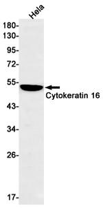 Cytokeratin 16 Antibody in Western Blot (WB)