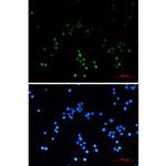 ZHX2 Recombinant Rabbit Monoclonal Antibody (K01_1L05)