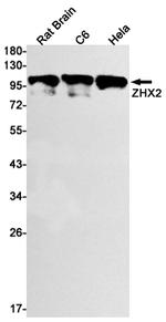 ZHX2 Antibody in Western Blot (WB)