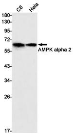 AMPK alpha-2 Recombinant Rabbit Monoclonal Antibody (K01_1M71)