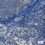 TAF3 Recombinant Rabbit Monoclonal Antibody (K01_1K58)