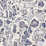 ARPC5 Recombinant Rabbit Monoclonal Antibody (K01_1L59)