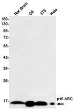 ARPC5 Antibody in Western Blot (WB)