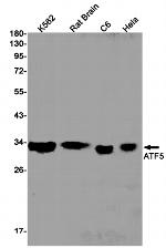 ATF5 Antibody in Western Blot (WB)