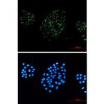 ACOX1 Recombinant Rabbit Monoclonal Antibody (K01_1M32)