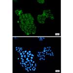 AKT3 Recombinant Rabbit Monoclonal Antibody (K01_1M50)