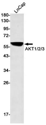 AKT3 Antibody in Western Blot (WB)