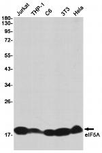eIF5A Antibody in Western Blot (WB)