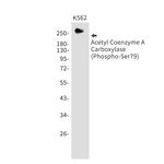 Phospho-Acetyl-CoA Carboxylase (Ser79) Recombinant Rabbit Monoclonal Antibody (K01_1M30)