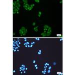 ELOVL5 Recombinant Rabbit Monoclonal Antibody (K01_1K33)